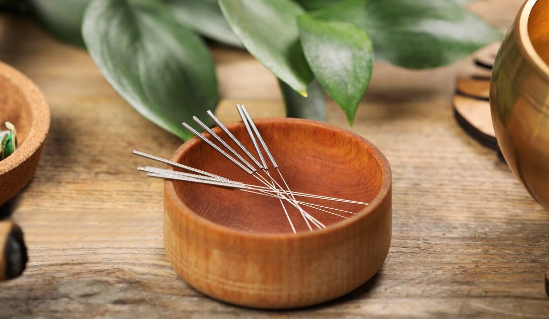 Benefits of Acupuncture in Comprehensive Well-being.